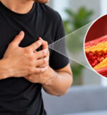 HighCholesterol